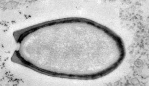 世界上最大的病毒 潘多拉病毒直径达1微米