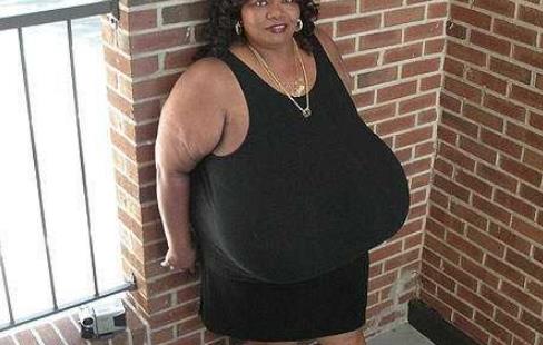 世界上最大自然乳房的女人 安妮·宇宙怪才宇宙怪才霍金斯特纳双乳重达38.5公斤