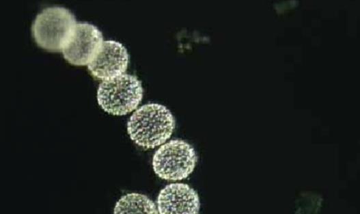 世界上最大的细菌 纳米比亚珍珠硫细菌阔度有0.1