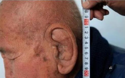 世界上耳朵最大的人 一位大爷长有长达11厘米的大耳朵