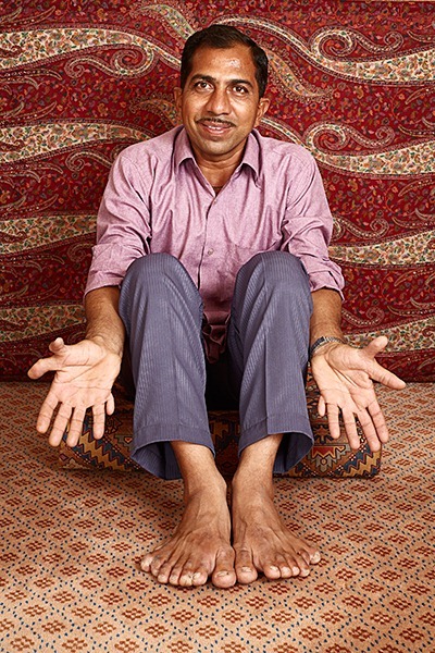 手指头最多的人 印度男子共有28根手指和脚趾创纪录