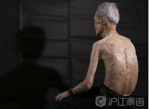 广岛幸存者的现在的照片，为什么广岛长崎核爆还能住人？