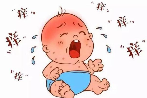 婴儿湿疹是奶粉过敏吗 宝宝奶粉过敏会起湿疹吗