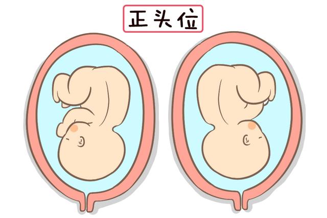 孕妇如何辨别胎儿的头（孕妈知道胎儿的头和脚在哪个位置吗）(3)