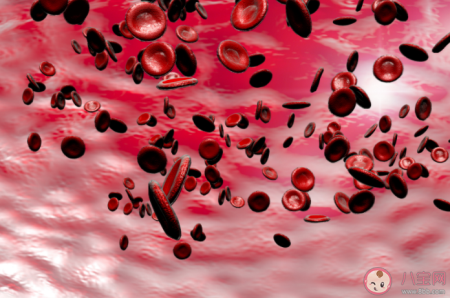 洗血脂能够预防高血脂吗 洗血脂有什么风险