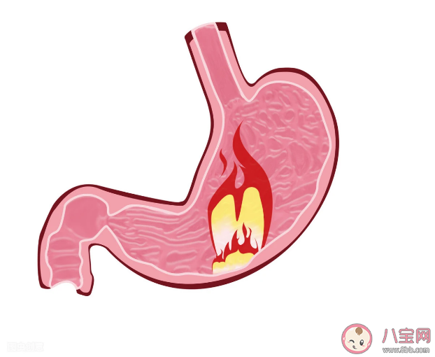 饭后怎么自测胃食管反流 胃食管反流病有哪些危害